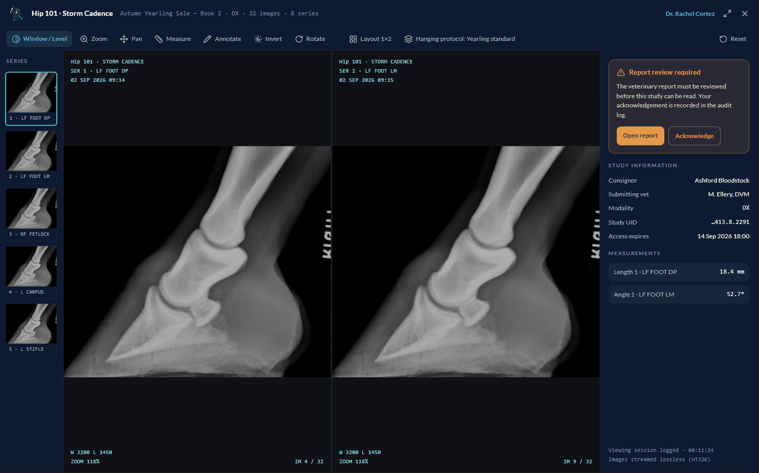 EquiLens radiograph viewer with window/level, measurement and report review gate