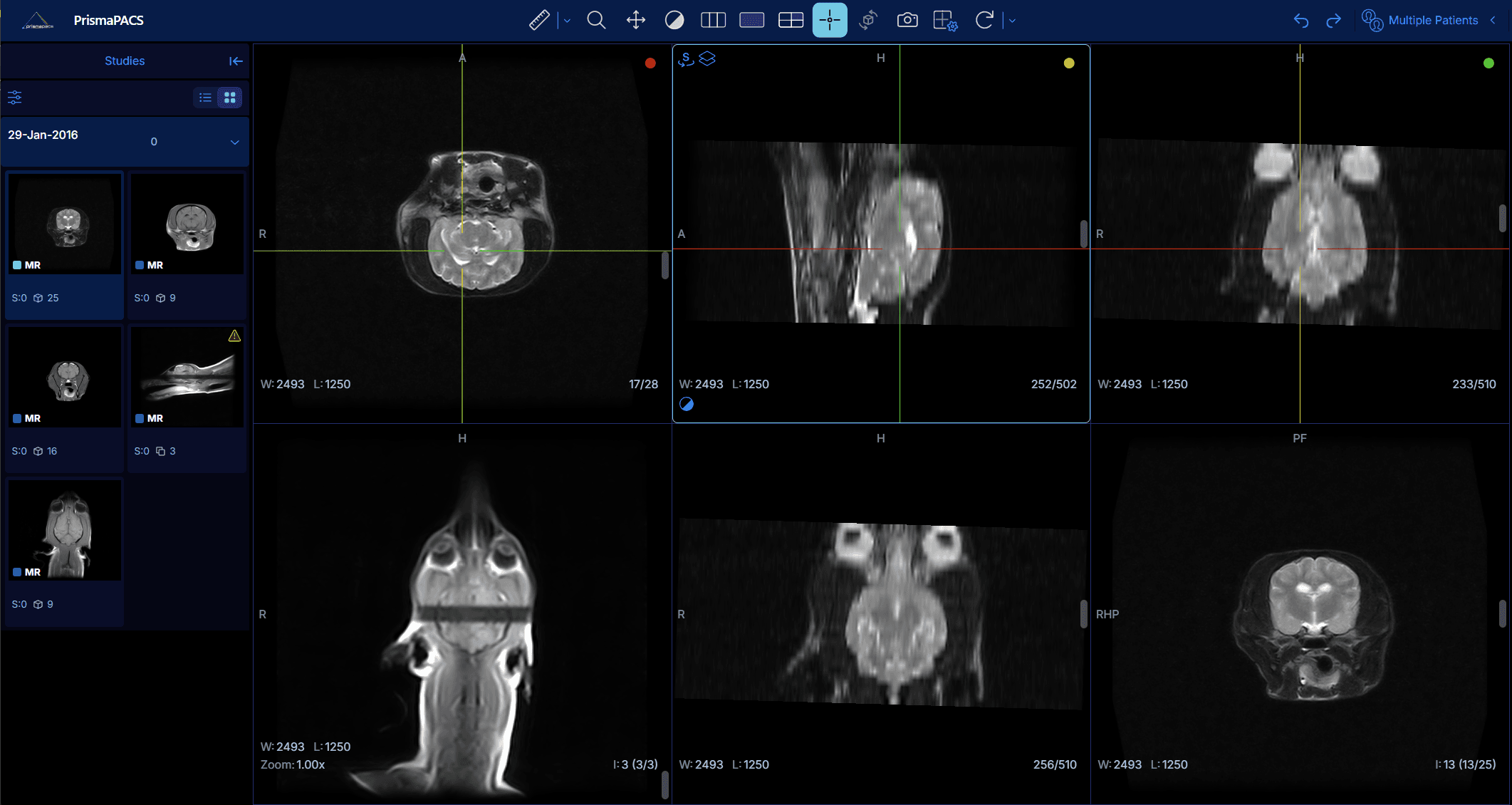 The PrismaPACS viewer